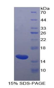 Horse INHBA / Inhibin Beta A Protein (Recombinant His)