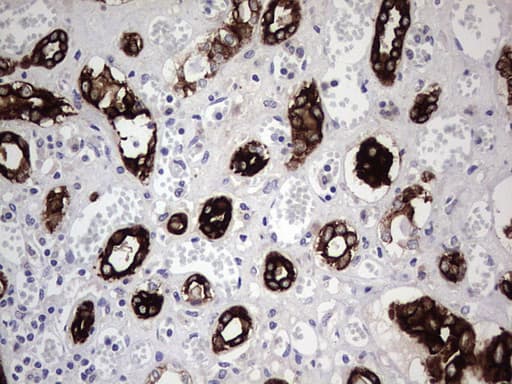 Monoclonal Mouse anti-Human KRT19 / CK19 / Cytokeratin 19 Antibody (clone OTI5H6, aa240-390, IHC, WB)