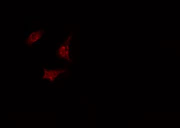 Polyclonal Rabbit anti-Human TAF5 Antibody (IHC, IF, WB)