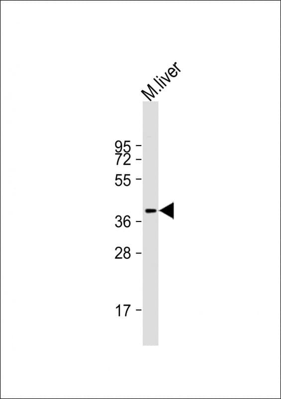 Polyclonal Rabbit anti-Human AKR7L Antibody (Internal, WB)