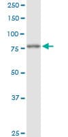 IHC-plus™ FOXK2 / ILF Antibody (clone 4A11)