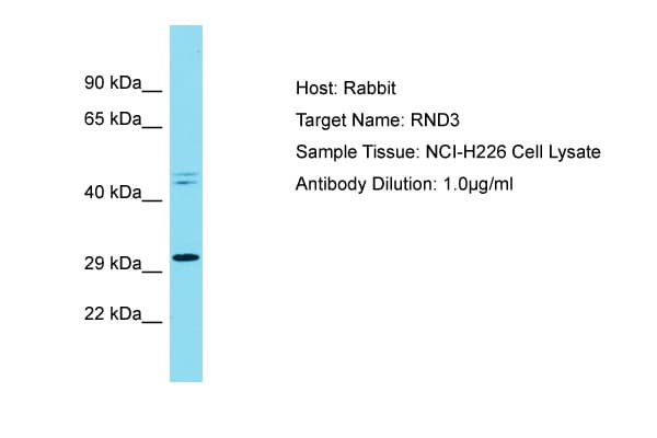 Polyclonal Rabbit anti-Human RHOE / RND3 Antibody (C-Terminus, WB)