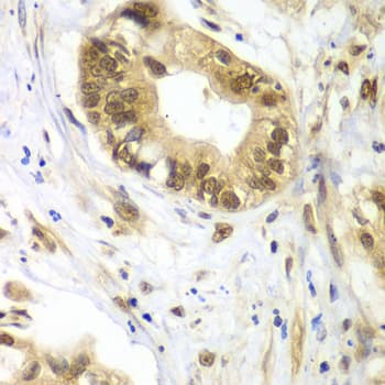 Polyclonal Rabbit anti-Human DDX1 Antibody (IHC, IF, WB)