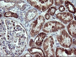 MMP13 Antibody (aa104-471, clone OTI2D8)