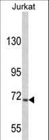 Polyclonal Rabbit anti-Human USP19 Antibody (aa1289-1319, WB)