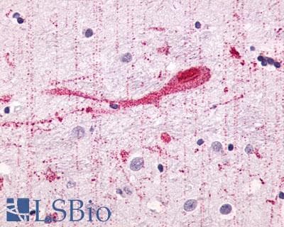 PathPlus™ Polyclonal Rabbit anti-Human GPR55 Antibody (Extracellular Domain, IHC)