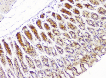 HECTD3 Antibody