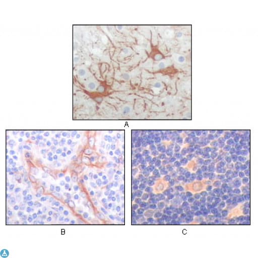 FES Antibody