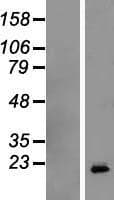 GH / Growth Hormone Protein (Over-Expression Lysate Myc-DDK (Flag))
