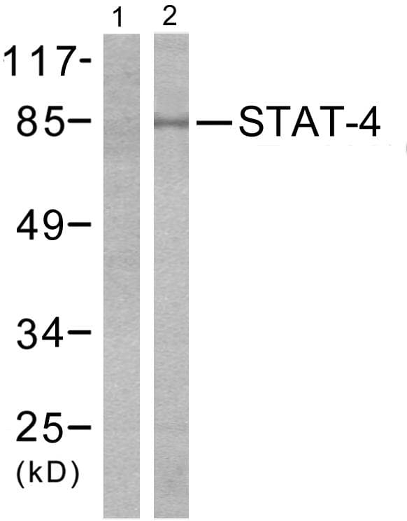 STAT4 Antibody (p693)