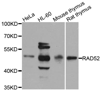 RAD52 Antibody