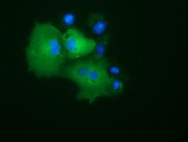 Monoclonal Mouse anti-Human PRKD2 / PKD2 Antibody (clone OTI5A3, IHC, IF, WB)