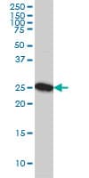 CLPP Antibody (clone 3E2)