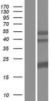 SFTPA1 / Surfactant Protein A (Over-Expression Lysate Myc-DDK (Flag))