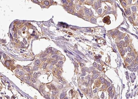 MAP3K5 / ASK1 Antibody (phospho-Ser83)