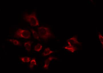 Polyclonal Rabbit anti-Human ATP5S Antibody (IF, WB)