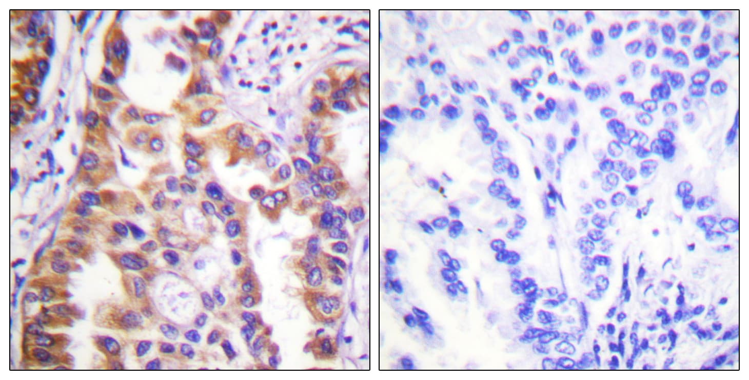 Tuberin / TSC2 Antibody (aa905-954)