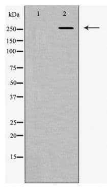 Polyclonal Rabbit anti-Human FN1 / Fibronectin Antibody (IHC, IF, WB)
