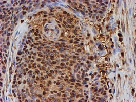 PSMB9 Antibody (clone OTI3F3)
