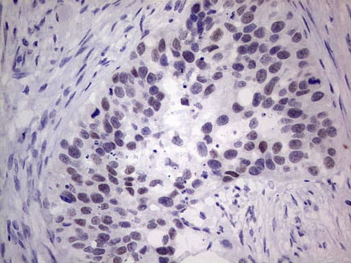 Monoclonal Mouse anti-Human MDM2 Antibody (clone OTI17B3, aa119-438, IHC, WB)