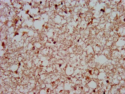 Polyclonal Rabbit anti-Human MKX Antibody (IHC, IF, WB)