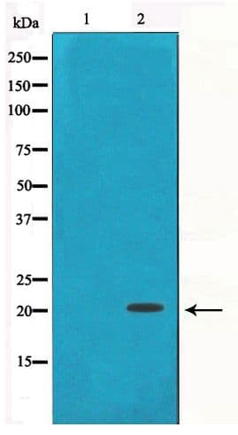 Polyclonal Rabbit anti-Human SNCG / Gamma-Synuclein Antibody (IHC, WB)