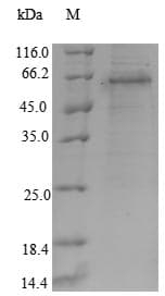 Mouse S100A8 / MRP8 Protein (Recombinant GST, N-terminus)