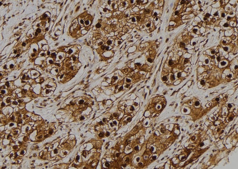 GB5 / GNB5 Antibody