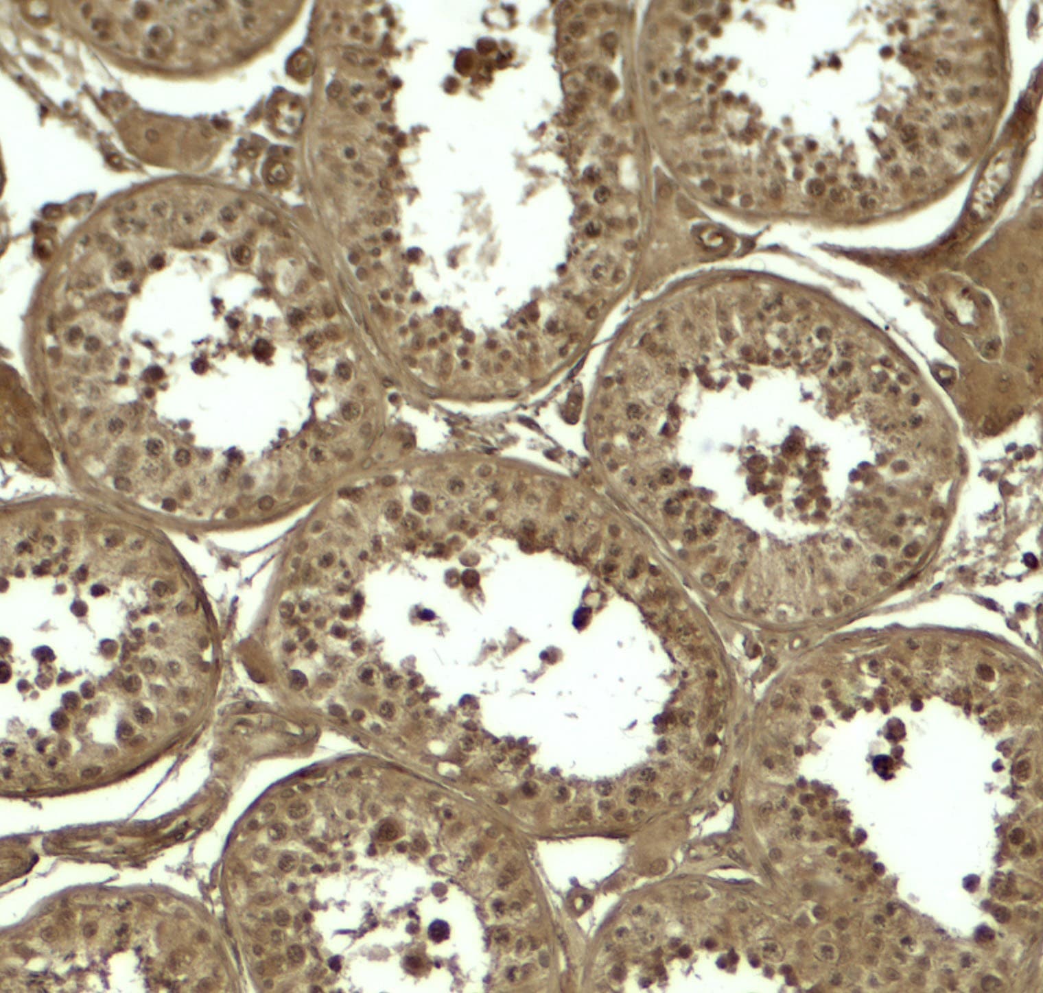 Polyclonal Rabbit anti-Human ATG4D Antibody (IHC, IF, WB)