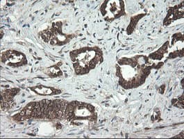 Monoclonal Mouse anti-Human UBE2J1 Antibody (clone OTI3C11, IHC, WB)