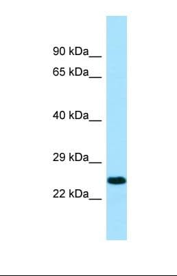 Polyclonal Rabbit anti-Human KIR2DL3 / CD152B2 Antibody (aa151-200, WB)