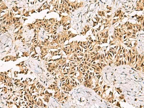 Polyclonal Rabbit anti-Human LRIF1 / RIF1 Antibody (IHC)