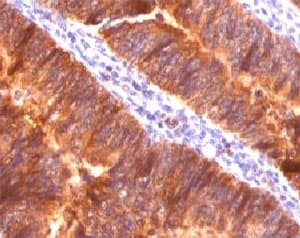 EMA / MUC1 Antibody (clone MCN01-1, Ready-to-Use)