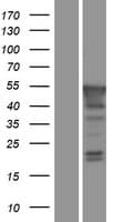 PBX4 Protein (Over-Expression Lysate Myc-DDK (Flag))