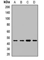 ENO3 / Enolase 3 Antibody