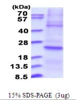 Human DUSP22 / JSP 1 Protein (Recombinant His)