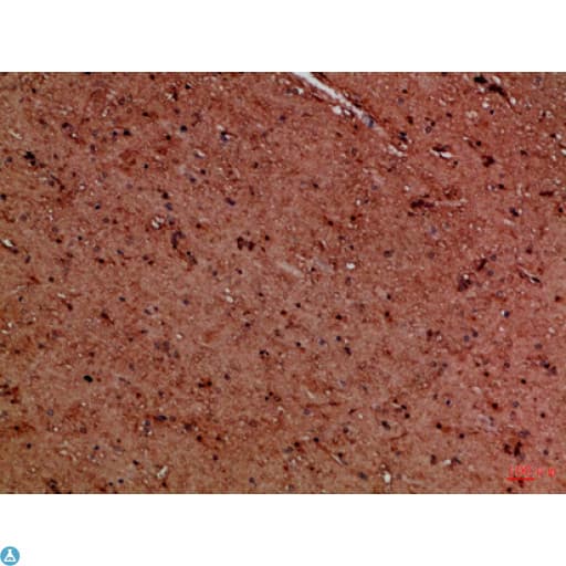 EYA1 Antibody