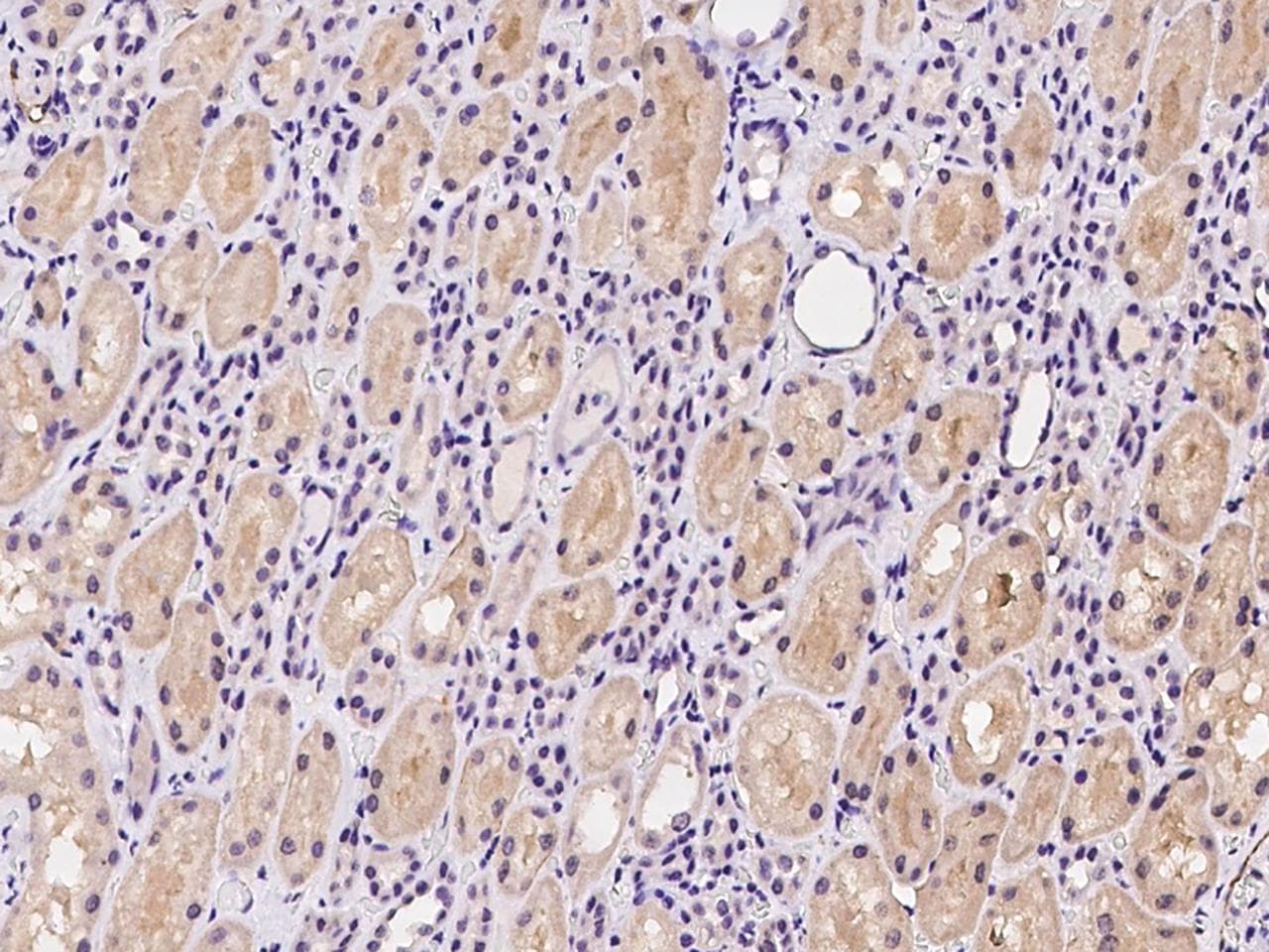Polyclonal Rabbit anti-Human C17orf96 Antibody (IHC)