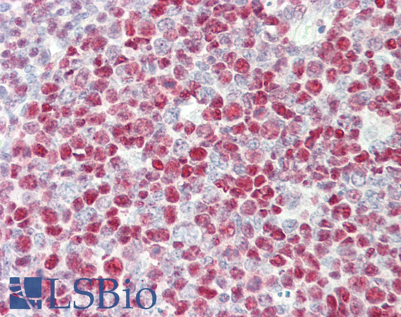 IHC-plus™ TERF2IP / RAP1 Antibody