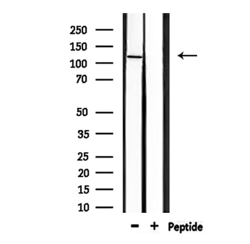 GRIA4 / GLUR4 Antibody