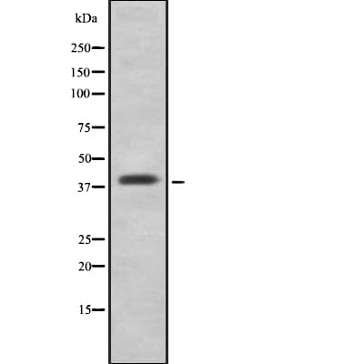 Polyclonal Rabbit anti-Human ATG3 Antibody (WB)