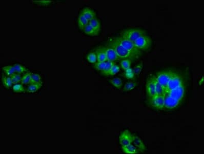 HAVCR2 / TIM-3 Antibody