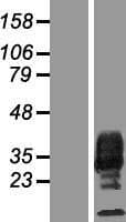 CSF1 / MCSF Protein (Over-Expression Lysate Myc-DDK (Flag))