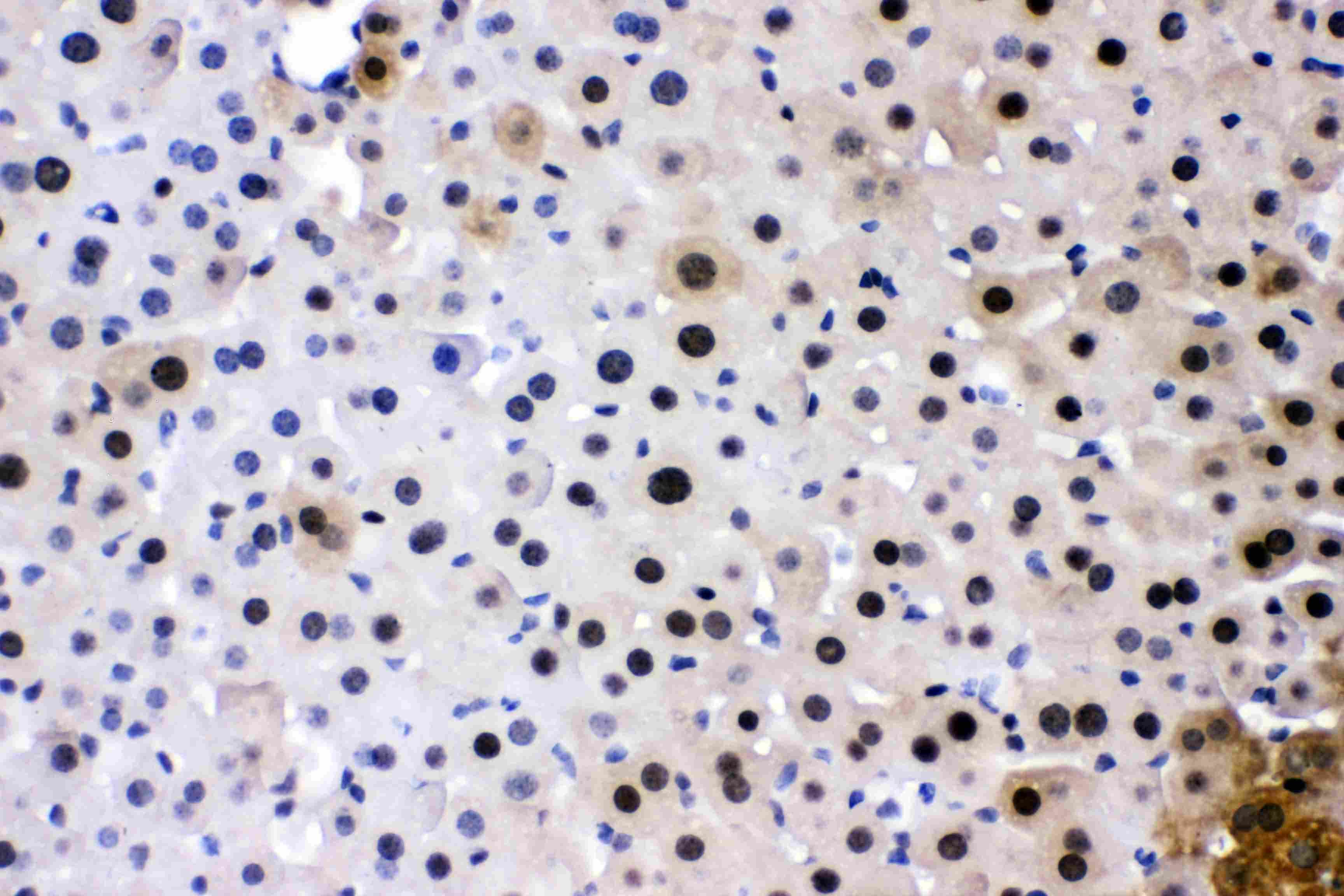 Polyclonal Rabbit anti-Human SUB1 Antibody (IHC, WB)