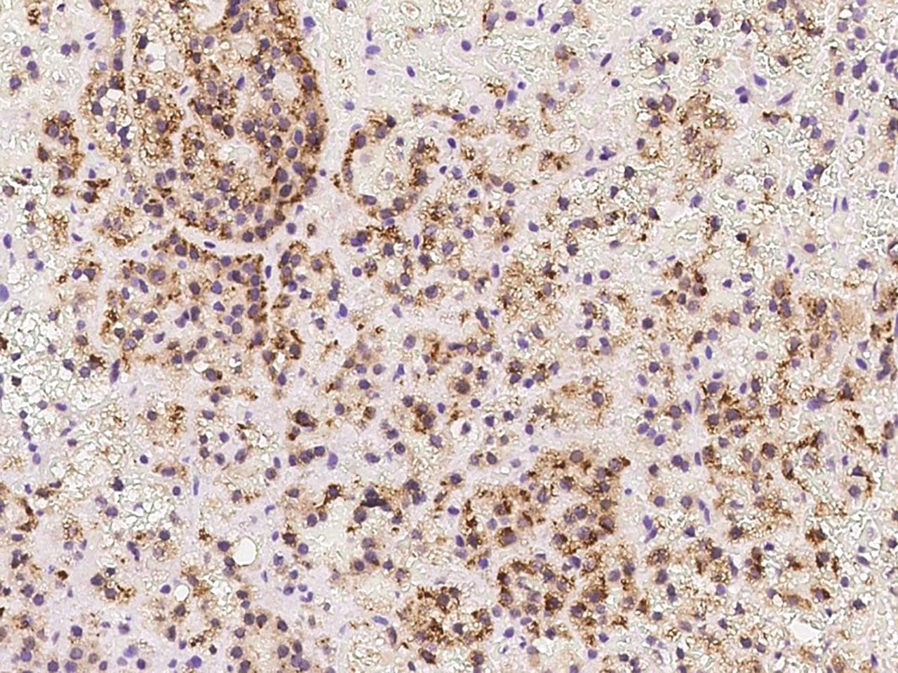 TAPT1 Antibody