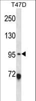ANKS6 Antibody (aa505-534)