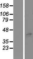 TSAP6 / STEAP3 Protein (Over-Expression Lysate Myc-DDK (Flag))
