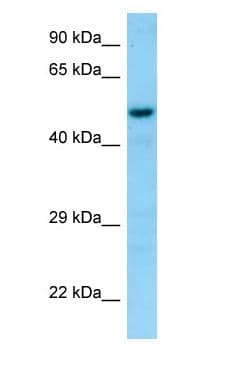 Polyclonal Rabbit anti-Human SNX6 Antibody (aa312-361, WB)