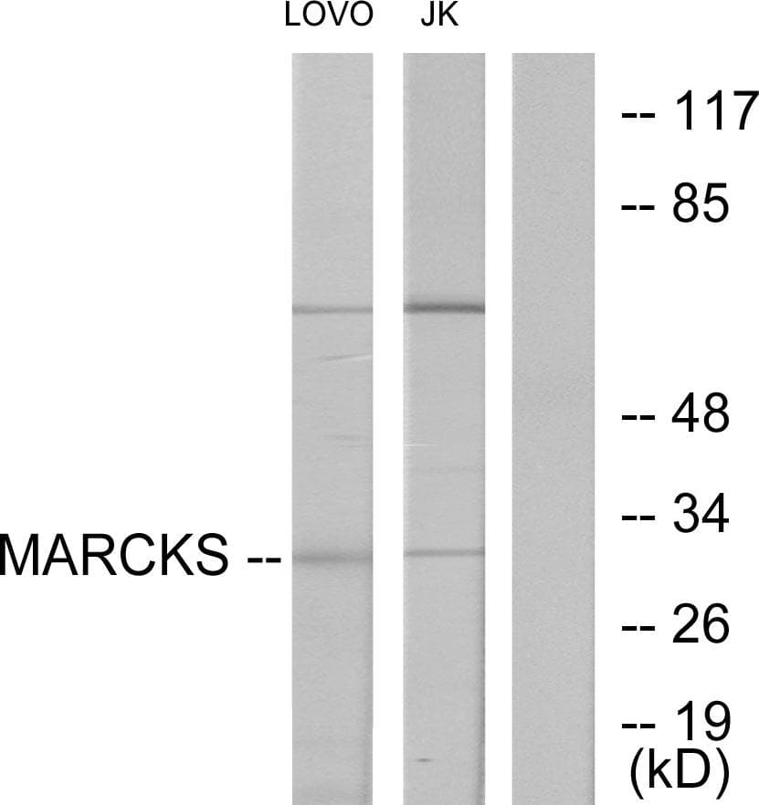 MARCKS Antibody (p162)