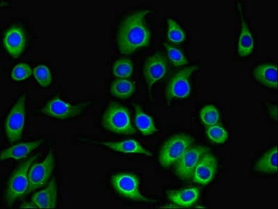 Polyclonal Rabbit anti-Human TESC Antibody (aa2-214, WB)